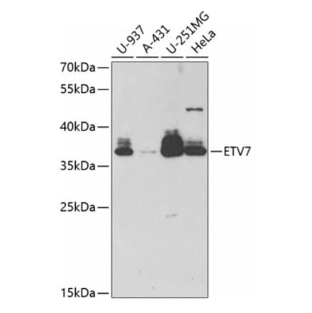 Western Blot - Anti-ETV7 Antibody (A11944) - Antibodies.com