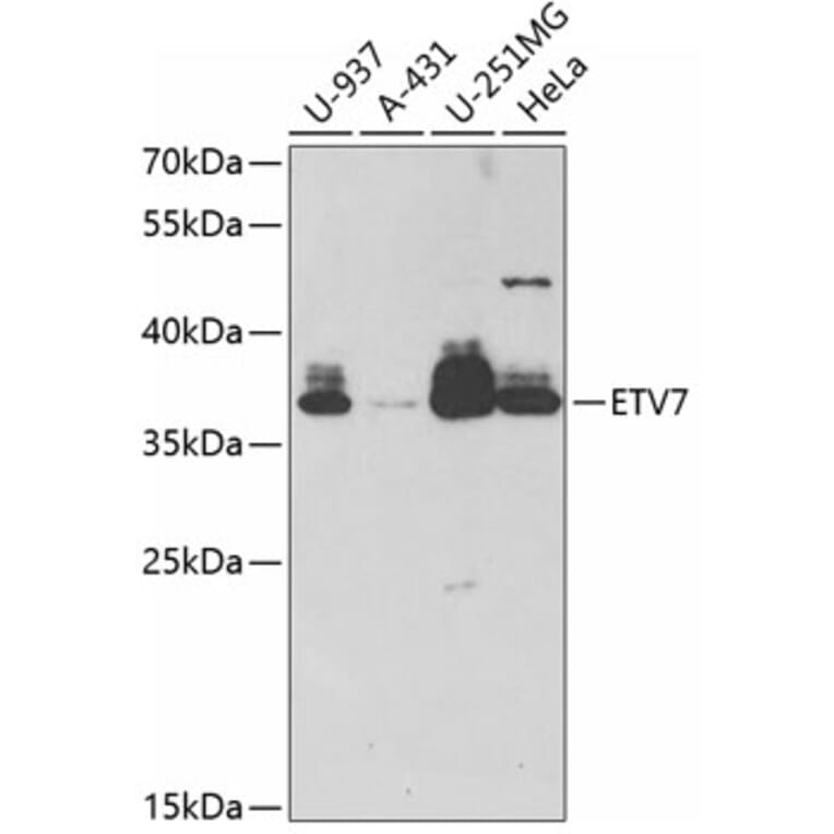 Western Blot - Anti-ETV7 Antibody (A11944) - Antibodies.com