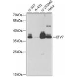 Western Blot - Anti-ETV7 Antibody (A11944) - Antibodies.com