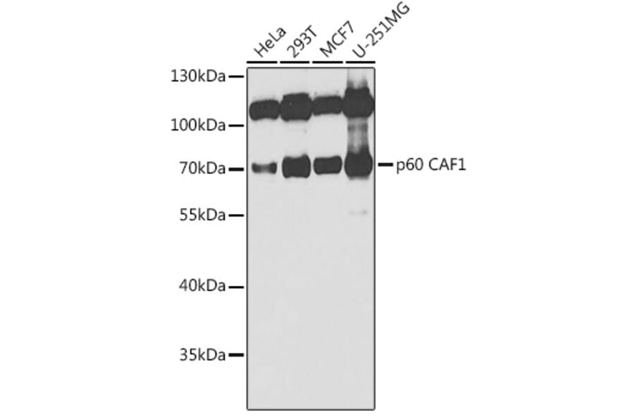 Western Blot - Anti-p60 CAF1/MPP7 Antibody (A11945) - Antibodies.com