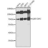 Western Blot - Anti-p60 CAF1/MPP7 Antibody (A11945) - Antibodies.com