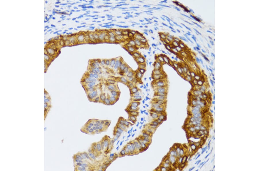 Immunohistochemistry - Anti-p60 CAF1/MPP7 Antibody (A11945) - Antibodies.com