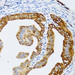 Immunohistochemistry - Anti-p60 CAF1/MPP7 Antibody (A11945) - Antibodies.com