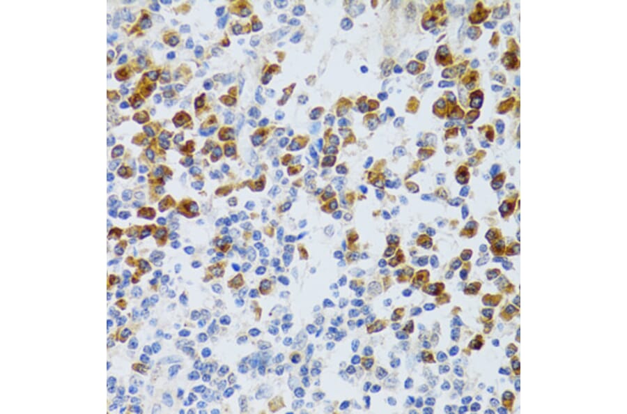Immunohistochemistry - Anti-p60 CAF1/MPP7 Antibody (A11945) - Antibodies.com