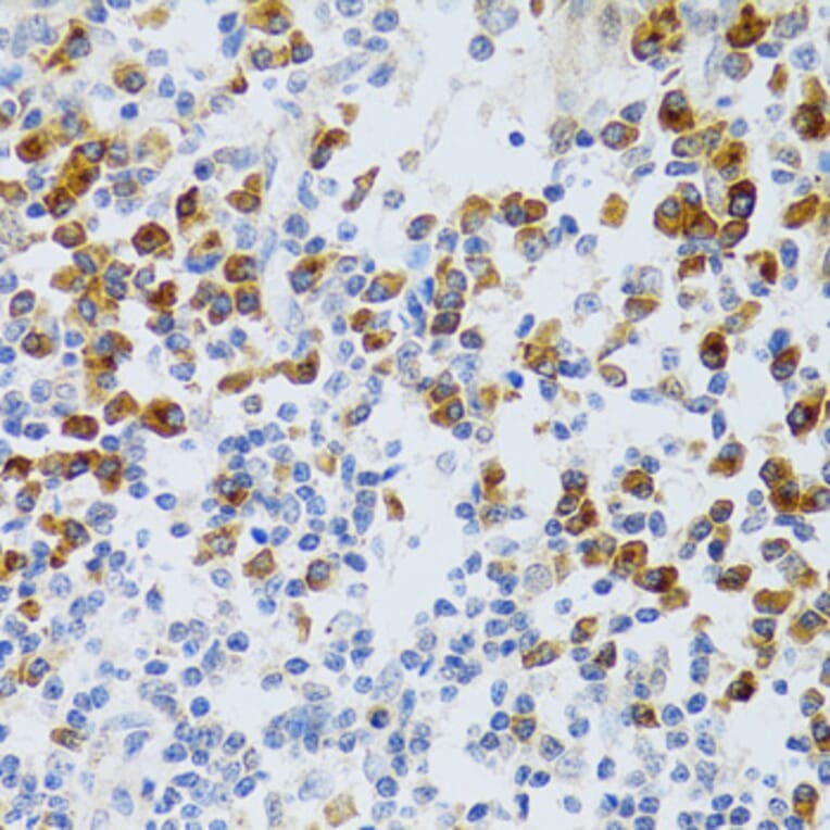 Immunohistochemistry - Anti-p60 CAF1/MPP7 Antibody (A11945) - Antibodies.com
