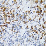 Immunohistochemistry - Anti-p60 CAF1/MPP7 Antibody (A11945) - Antibodies.com