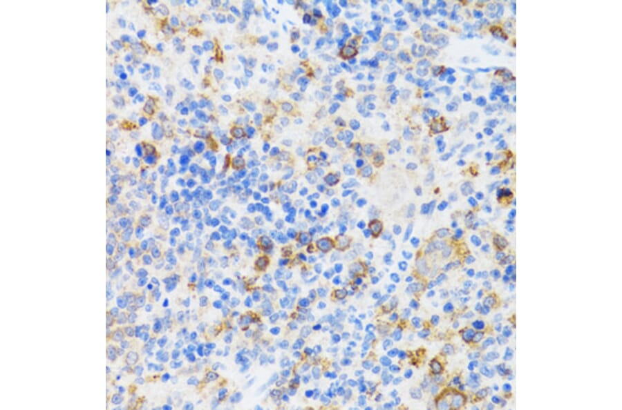 Immunohistochemistry - Anti-p60 CAF1/MPP7 Antibody (A11945) - Antibodies.com