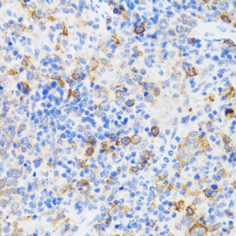 Immunohistochemistry - Anti-p60 CAF1/MPP7 Antibody (A11945) - Antibodies.com