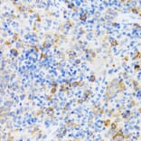 Immunohistochemistry - Anti-p60 CAF1/MPP7 Antibody (A11945) - Antibodies.com