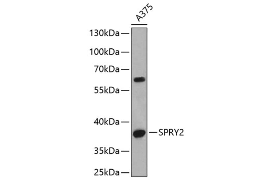 Western Blot - Anti-SPRY2 Antibody (A6262) - Antibodies.com