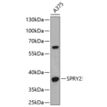 Western Blot - Anti-SPRY2 Antibody (A6262) - Antibodies.com