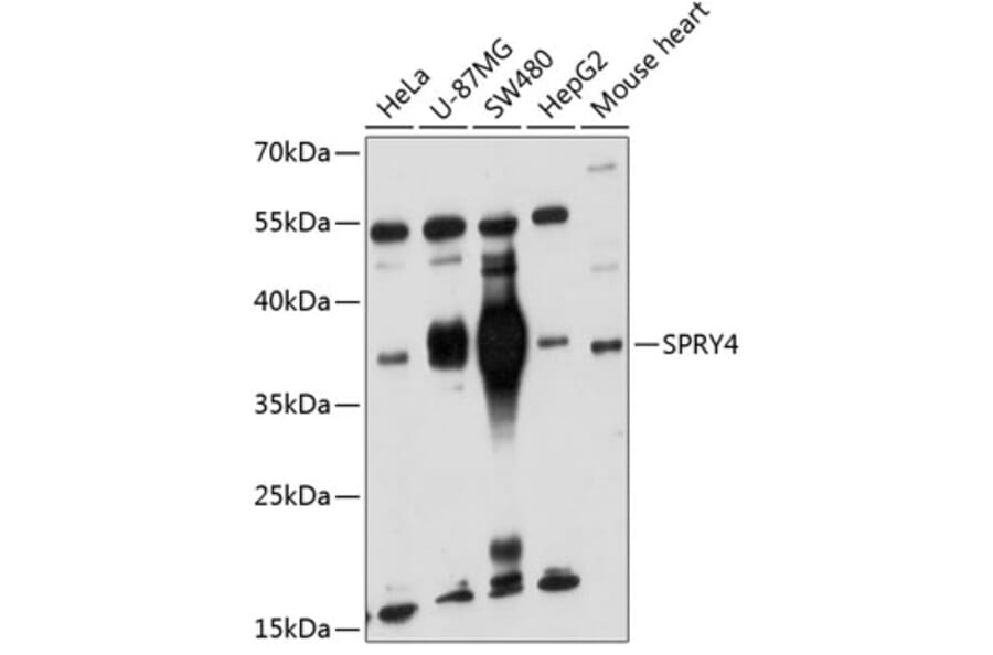 Western Blot - Anti-Sprouty 4/Spry-4 Antibody (A11947) - Antibodies.com