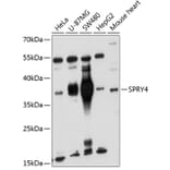 Western Blot - Anti-Sprouty 4/Spry-4 Antibody (A11947) - Antibodies.com