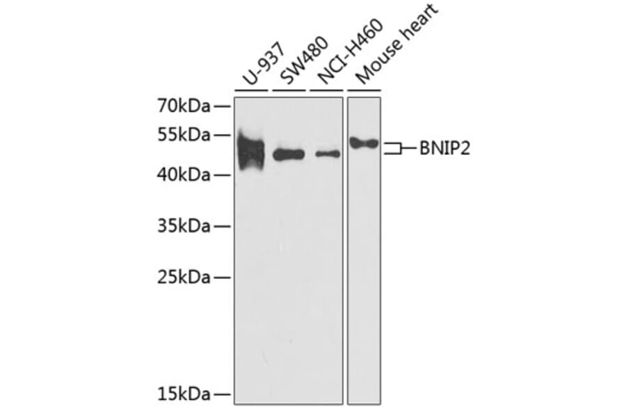 Western Blot - Anti-BNIP2 Antibody (A11948) - Antibodies.com