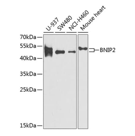 Western Blot - Anti-BNIP2 Antibody (A11948) - Antibodies.com