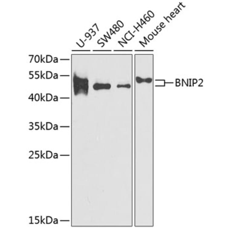 Western Blot - Anti-BNIP2 Antibody (A11948) - Antibodies.com