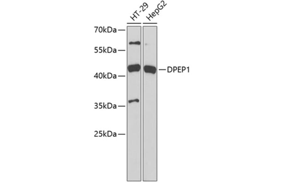 Western Blot - Anti-DPEP1/MDP Antibody (A11949) - Antibodies.com