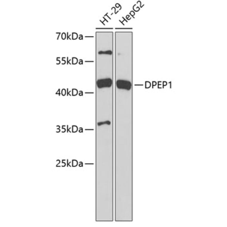 Western Blot - Anti-DPEP1/MDP Antibody (A11949) - Antibodies.com