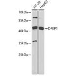 Western Blot - Anti-DPEP1/MDP Antibody (A11949) - Antibodies.com