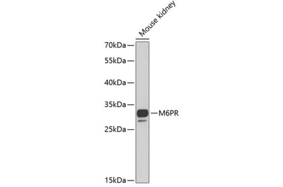 Western Blot - Anti-M6PR Antibody (A6296) - Antibodies.com