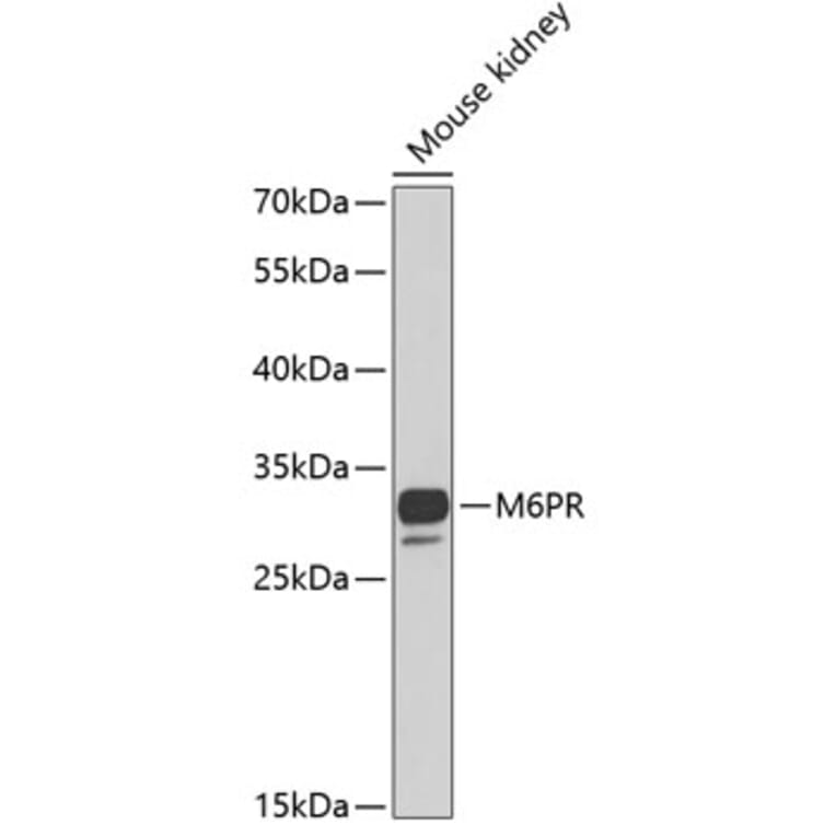 Western Blot - Anti-M6PR Antibody (A6296) - Antibodies.com