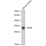 Western Blot - Anti-M6PR Antibody (A6296) - Antibodies.com