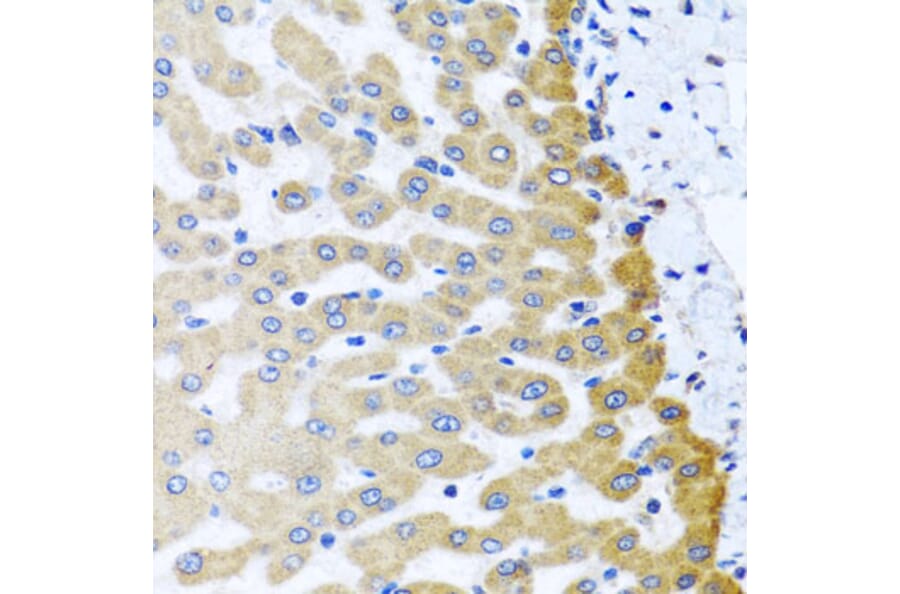 Immunohistochemistry - Anti-M6PR Antibody (A6296) - Antibodies.com