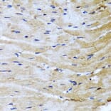 Immunohistochemistry - Anti-M6PR Antibody (A6296) - Antibodies.com