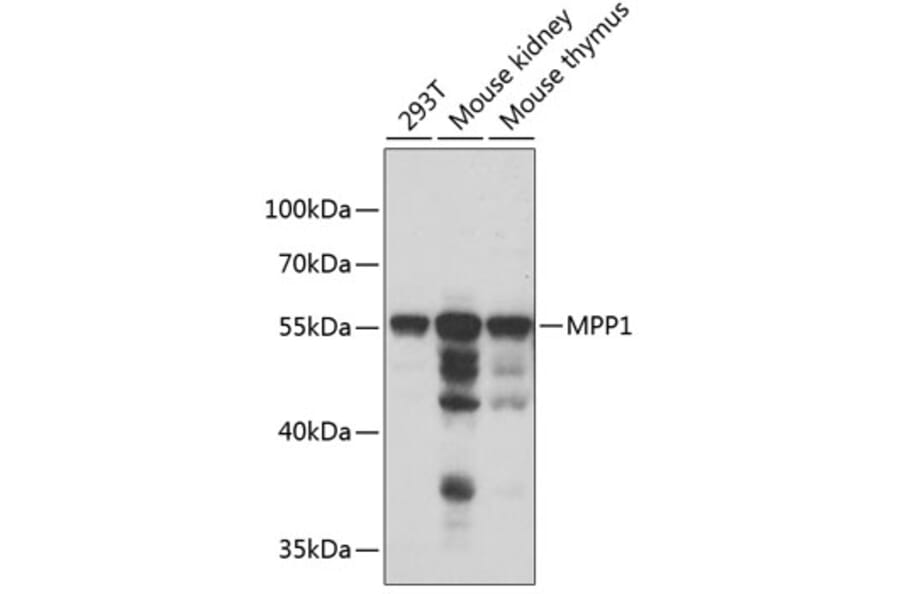 Western Blot - Anti-MPP1 Antibody (A6298) - Antibodies.com