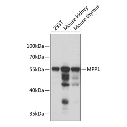 Western Blot - Anti-MPP1 Antibody (A6298) - Antibodies.com