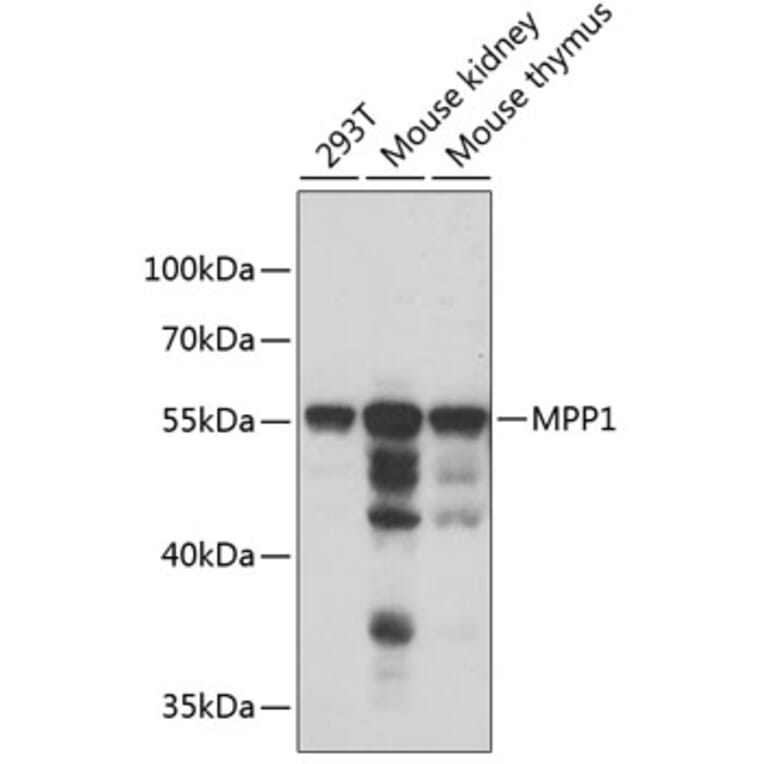 Western Blot - Anti-MPP1 Antibody (A6298) - Antibodies.com