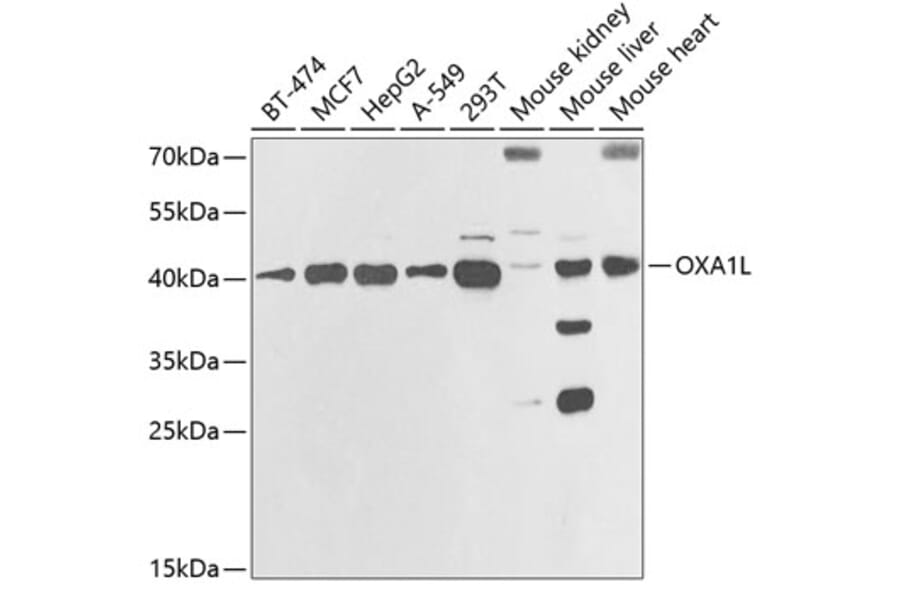 Western Blot - Anti-OXA1L Antibody (A11952) - Antibodies.com