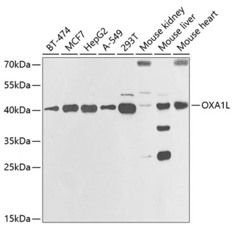 Western Blot - Anti-OXA1L Antibody (A11952) - Antibodies.com