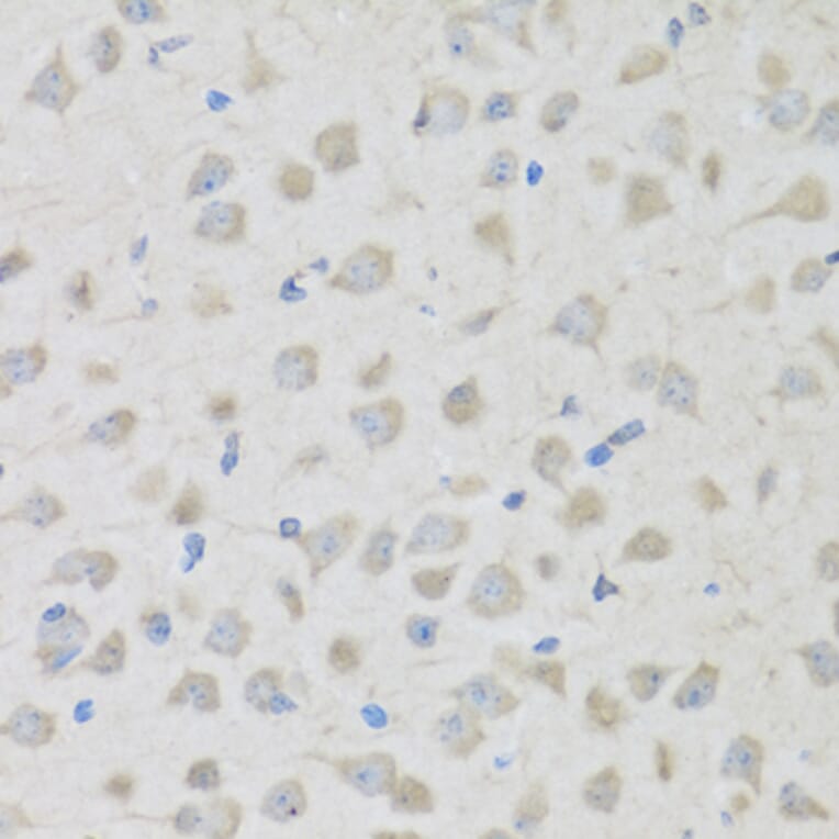 Immunohistochemistry - Anti-Enkephalin/ENK Antibody (A11953) - Antibodies.com