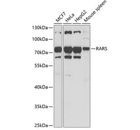 Western Blot - Anti-RARS Antibody (A11954) - Antibodies.com