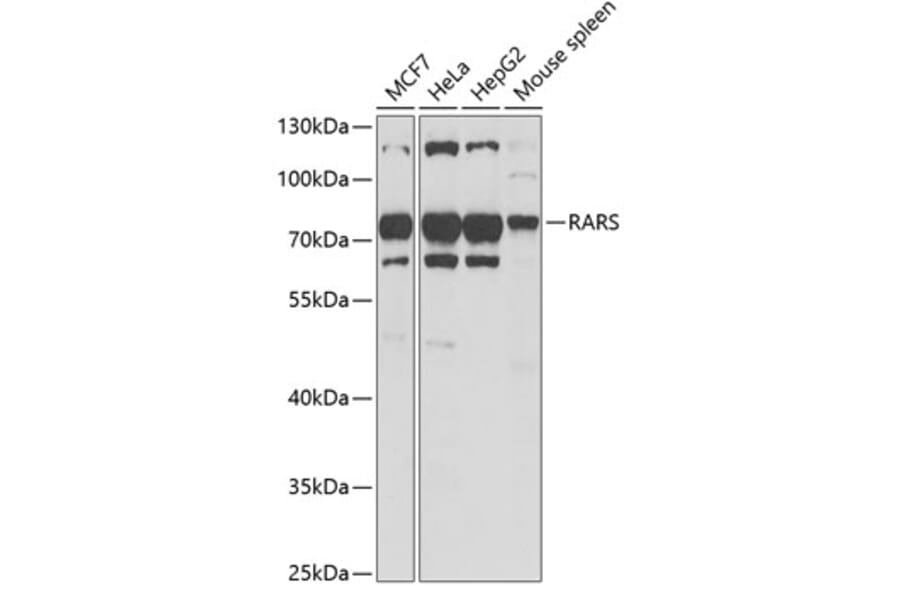 Western Blot - Anti-RARS Antibody (A11954) - Antibodies.com