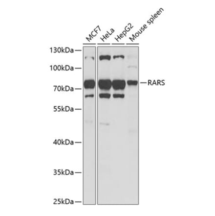 Western Blot - Anti-RARS Antibody (A11954) - Antibodies.com
