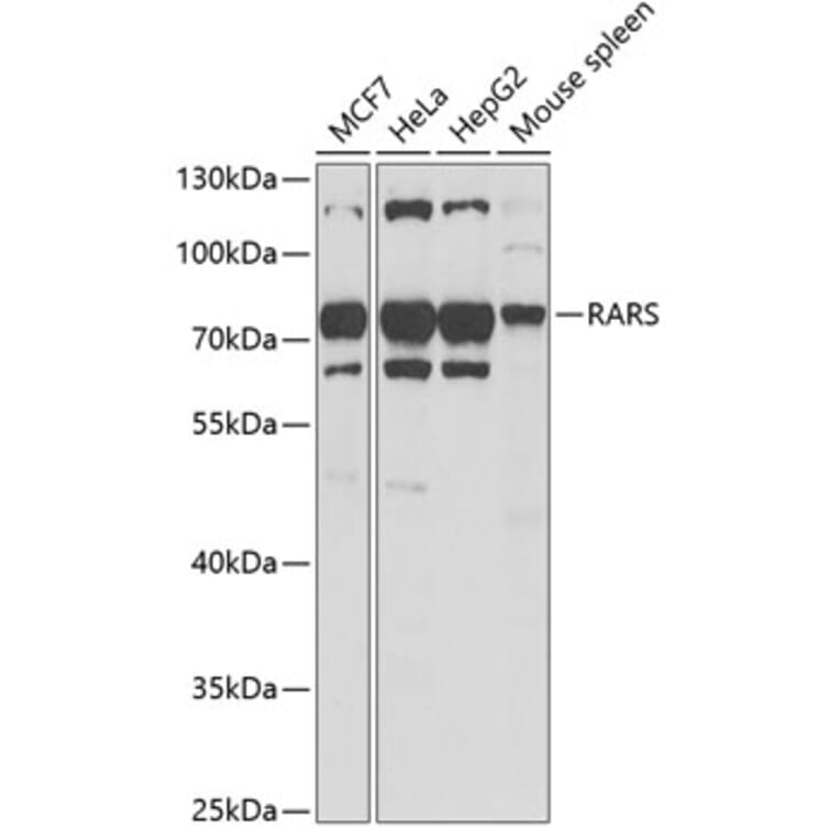 Western Blot - Anti-RARS Antibody (A11954) - Antibodies.com