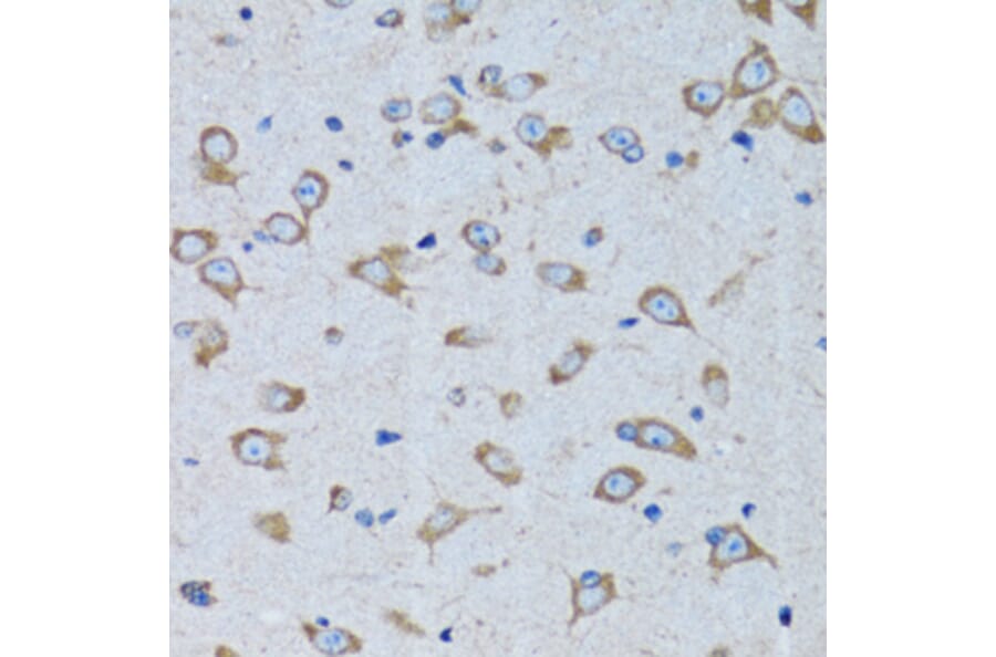 Immunohistochemistry - Anti-RARS Antibody (A11954) - Antibodies.com