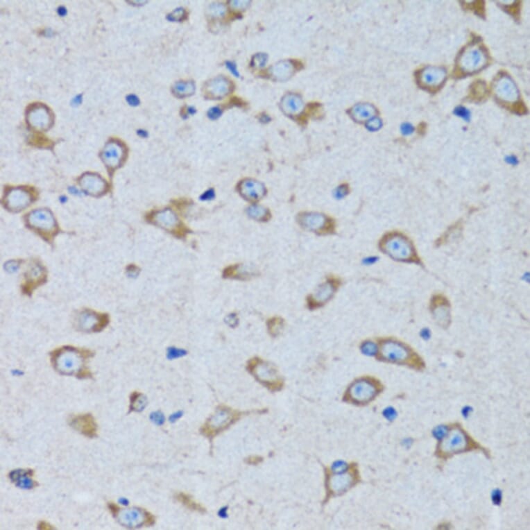 Immunohistochemistry - Anti-RARS Antibody (A11954) - Antibodies.com