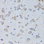 Immunohistochemistry - Anti-RARS Antibody (A11954) - Antibodies.com