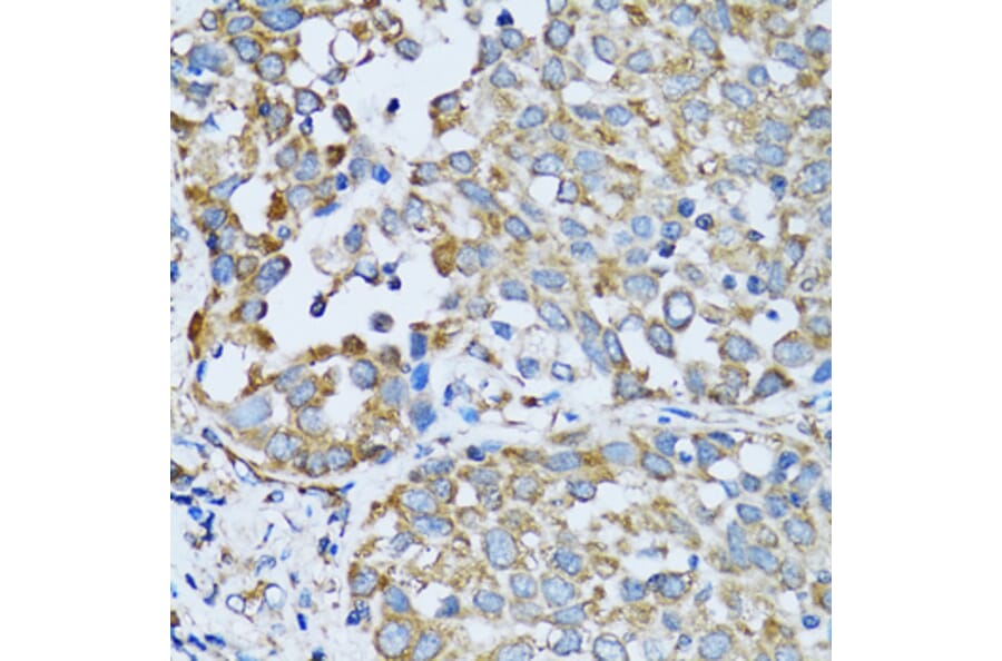 Immunohistochemistry - Anti-RARS Antibody (A11954) - Antibodies.com