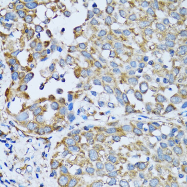 Immunohistochemistry - Anti-RARS Antibody (A11954) - Antibodies.com