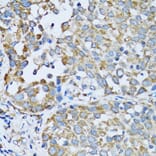 Immunohistochemistry - Anti-RARS Antibody (A11954) - Antibodies.com