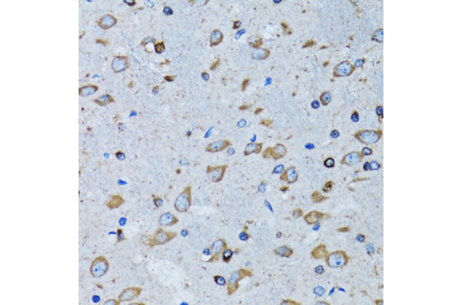Immunohistochemistry - Anti-RARS Antibody (A11954) - Antibodies.com
