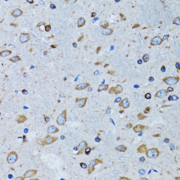 Immunohistochemistry - Anti-RARS Antibody (A11954) - Antibodies.com