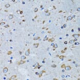 Immunohistochemistry - Anti-RARS Antibody (A11954) - Antibodies.com