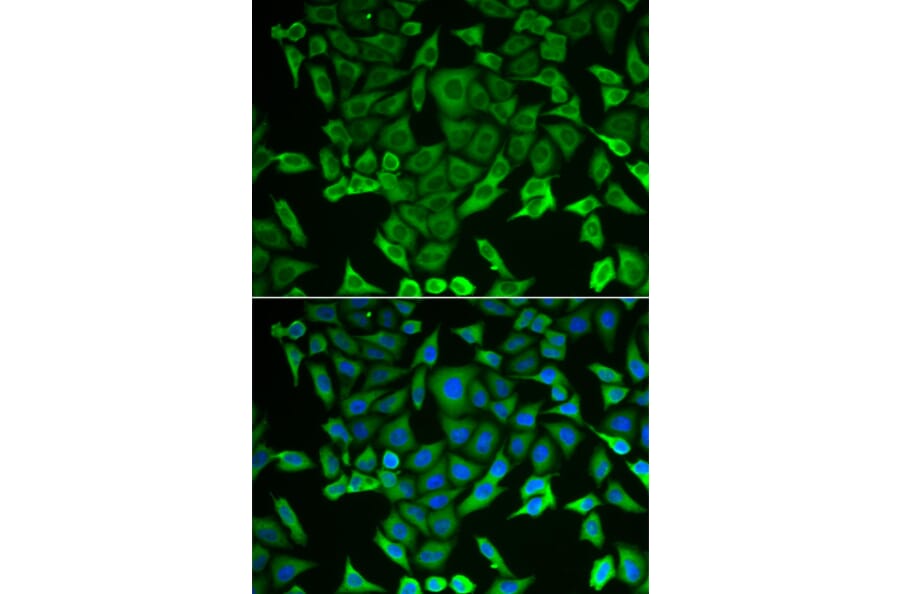 Immunofluorescence - Anti-RARS Antibody (A11954) - Antibodies.com