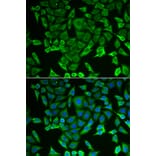 Immunofluorescence - Anti-RARS Antibody (A11954) - Antibodies.com