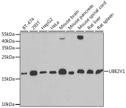 Western blot analysis of extracts of various cell lines, using Anti-UBE2V1 Antibody (A6316) at 1:1,000 dilution.
Secondary antibody: Goat Anti-Rabbit IgG (H+L) (HRP) (AS014) at 1:10,000 dilution.
Lysates / proteins: 25µg per lane.
Blocking buffer: 3% non-fat dry milk in TBST.
Detection: ECL Basic Kit (RM00020).
Exposure time: 90s.